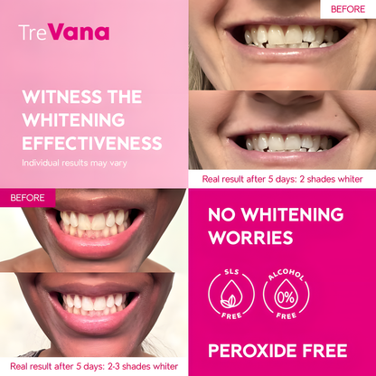 TreVana™ Natural Whitening Strips